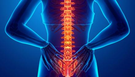 Back pain radiating on a person's spinal column