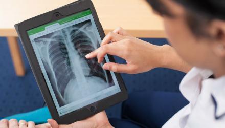 Physios help develop new NICE guideline on cystic fibrosis